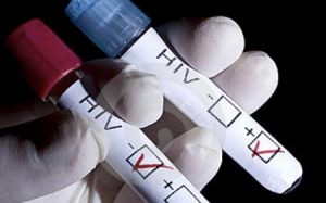 sida-hiv